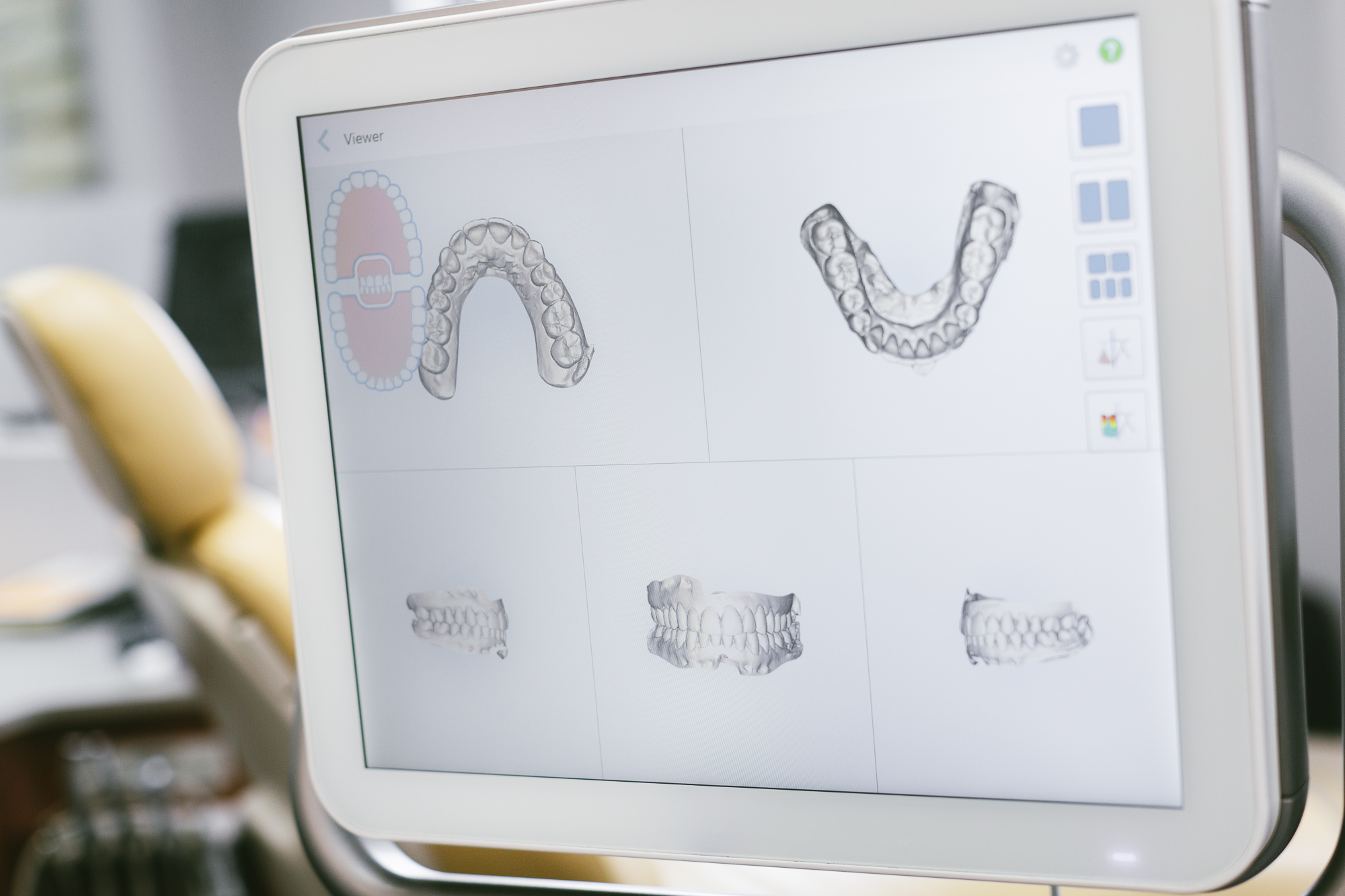 How Braces Work to Straighten Your Teeth - Digital Scan